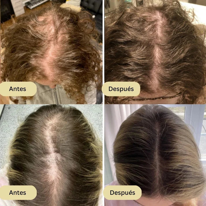 ACEITE NATURAL VEGANIC PARA EL CABELLO