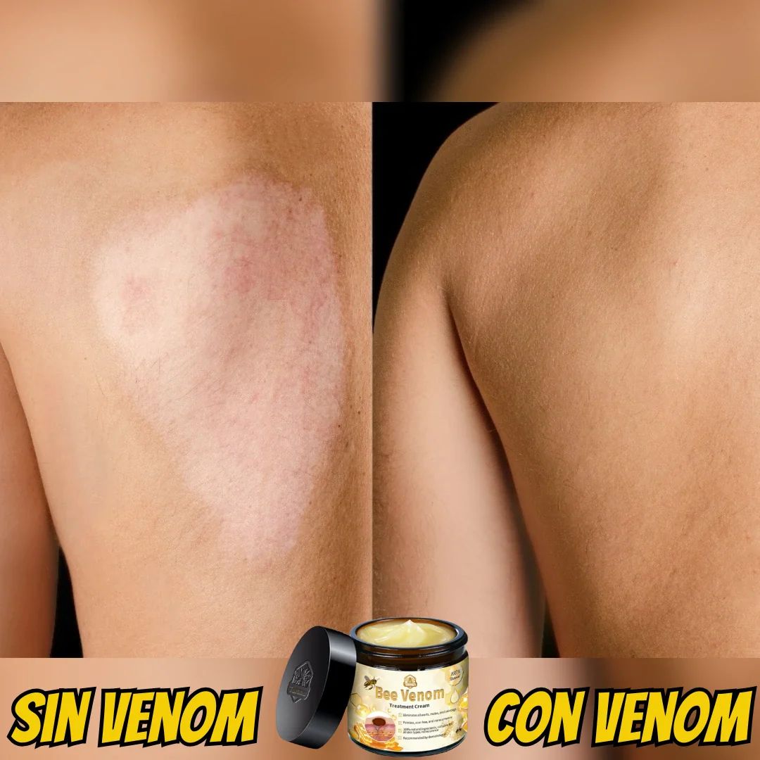 Bee Venom Cream – Regeneración de Piel y Alivio Muscular