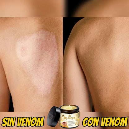 Bee Venom Cream – Regeneración de Piel y Alivio Muscular