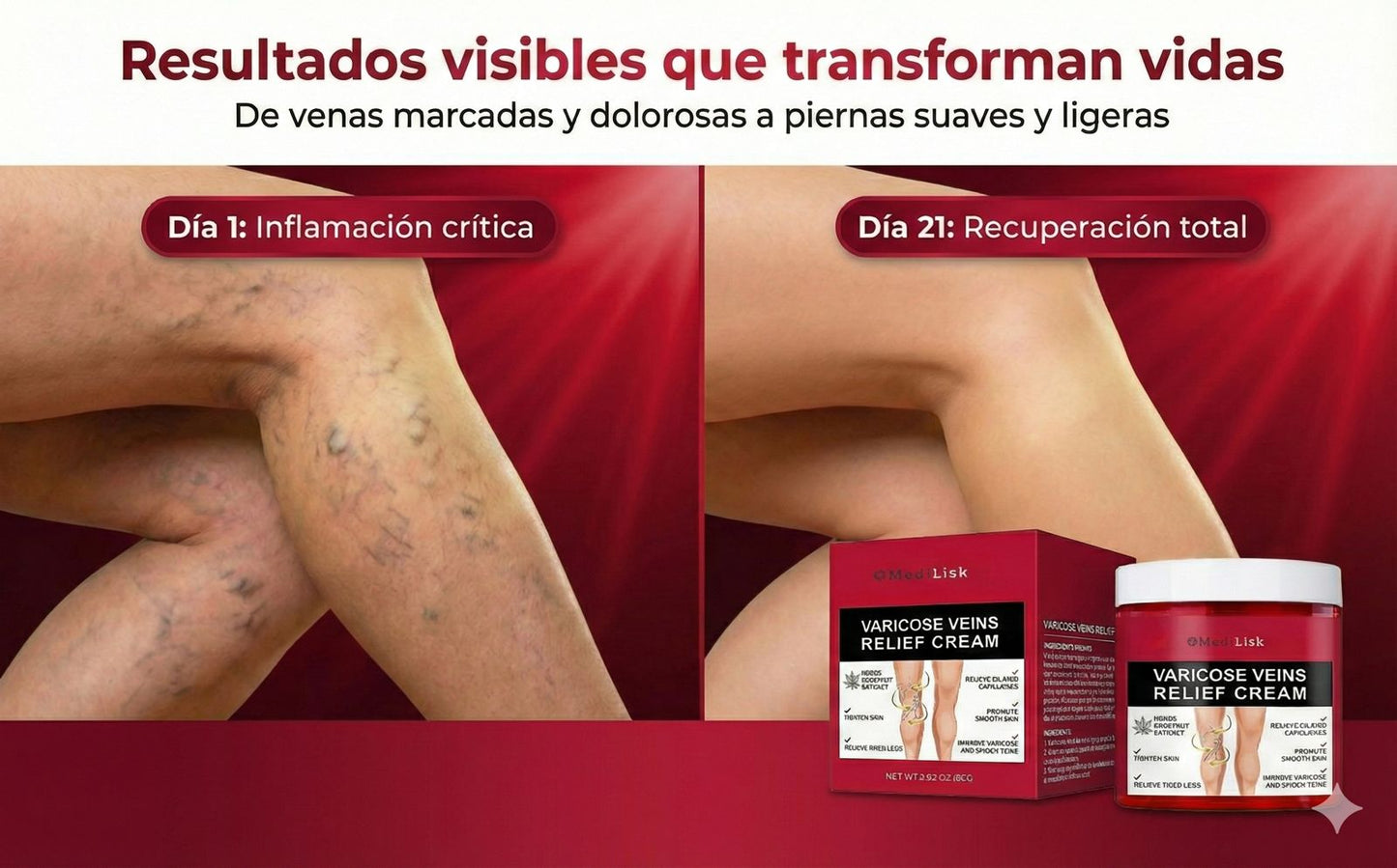 MEDILISK-CREMA PARA ELIMINAR VARICES